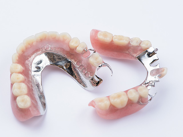 金属床義歯1